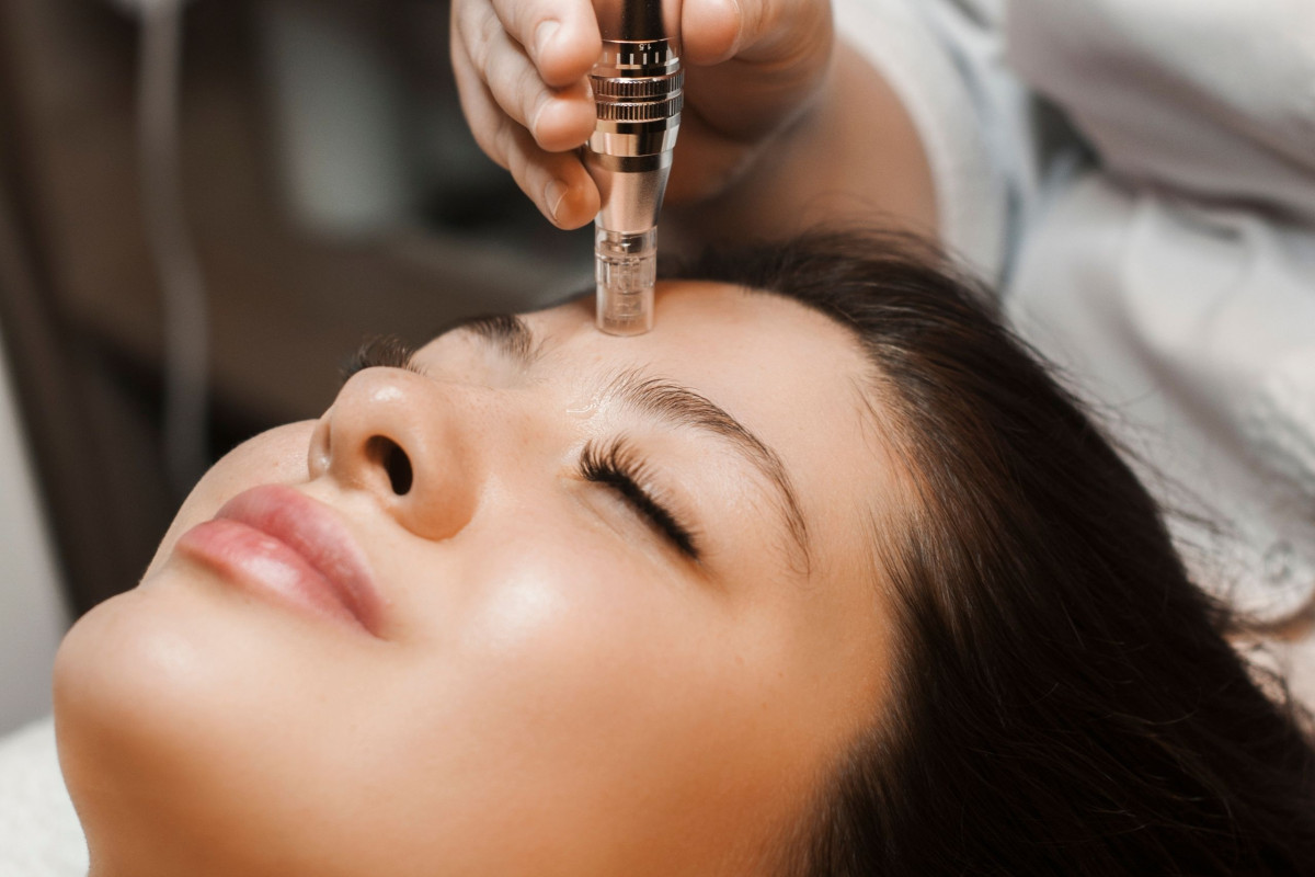Micro-needling mesotherapy