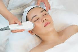 RF Fractional micro-needling neck x6 treatment