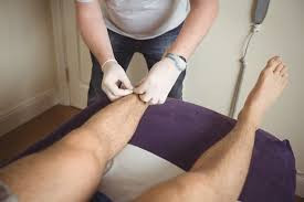 Full leg